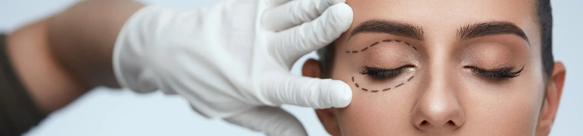Unterlidstraffung Düsseldorf